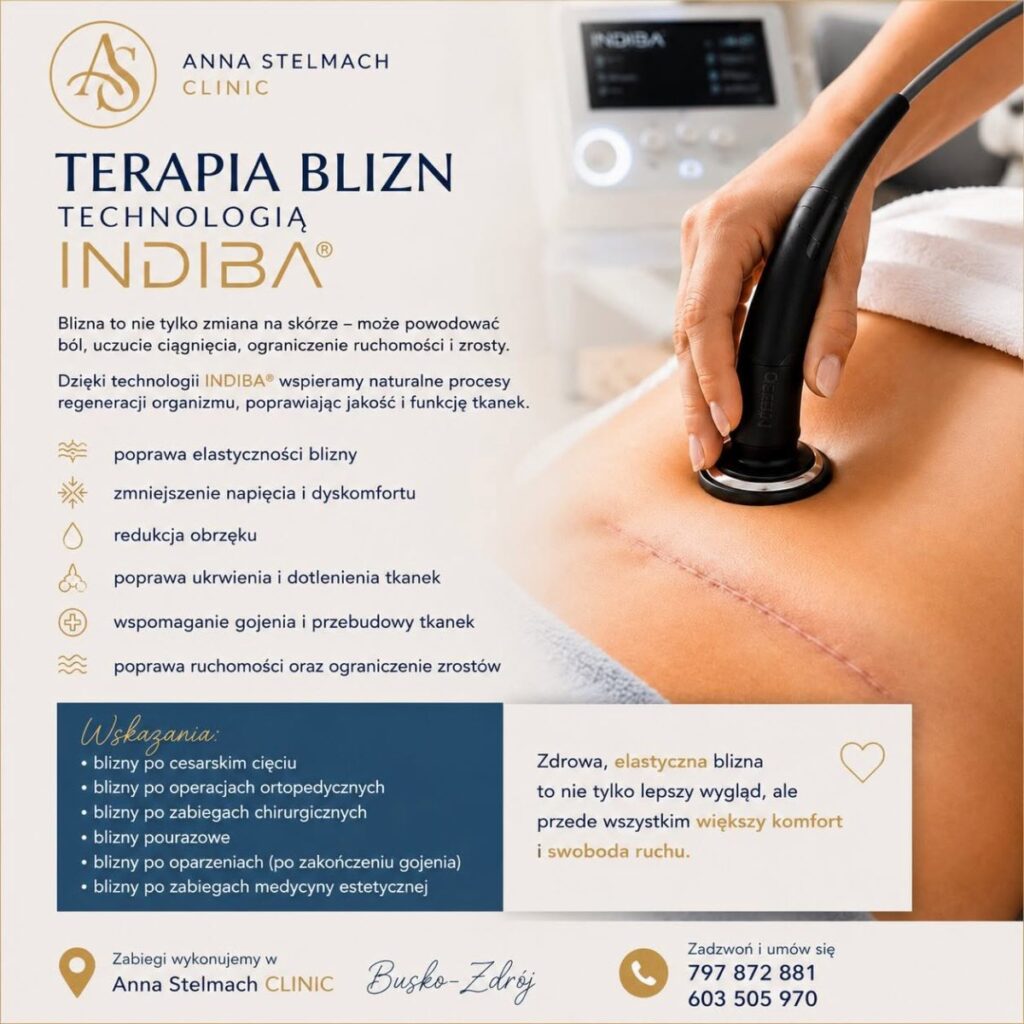 anna stelmach clinic Nowoczesna terapia blizn w Anna Stelmach CLINIC w Busku Zdroju